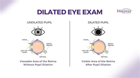 john lewis eye test